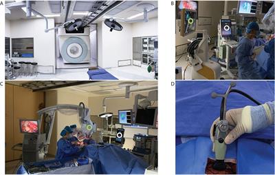 Full-course resection control strategy in glioma surgery using both intraoperative ultrasound and intraoperative MRI